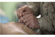 Acupuncture & Traditional Chinese Medicine Toowoomba image 2