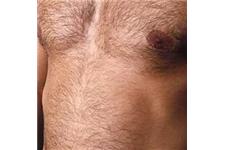 Australian Laser & Skin Clinic image 11