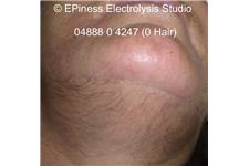 EPIness Electrolysis Studio image 1