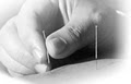 Hawthorn Acupuncture Clinic image 3