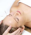 Mingman Acupuncture Clinic image 1