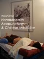 Vicki Ball Acupuncture-Honourhealth image 1