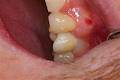 Aesthetic Solutions Dental Ceramics image 6