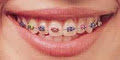 AllStar Orthodontics logo