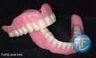 Brisbane Dentures Relines Repairs Southside image 3