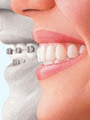 Class 1 Orthodontics logo