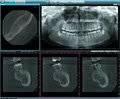 Cosmic Smile Imaging image 4