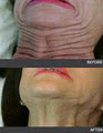 Dermal Fillers & Wrinkle Relaxers Port Hedland logo