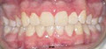 Dr Ashwani Gupta, Orthodontist image 2