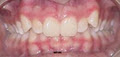 Dr Ashwani Gupta, Orthodontist image 3