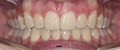 Dr Ashwani Gupta, Orthodontist image 4