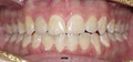 Dr Ashwani Gupta, Orthodontist image 6