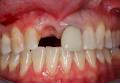 Elite Perio Implant and Periodontal Centre image 4