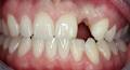 Elite Perio Implant and Periodontal Centre image 5