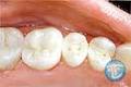 Finkelstein Dental Centre logo