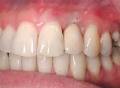 Greenhill Periodontics & Implants image 2