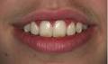 Greenhill Periodontics & Implants image 4