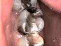 Love Your Smile Dental Care image 1