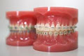 Orthodontic Network in Adelaide image 2