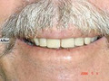 Robert Collins Dental Prosthetist image 5