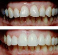 Today's Dentistry - North Brisbane Family and Cosmetic Dentist image 2