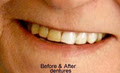 Uniquely You Teeth Whitening image 6