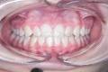 Vision Dental image 1