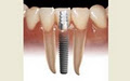 ADVANCED DENTAL SERVICES image 5