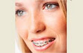 ADVANCED DENTAL SERVICES image 6