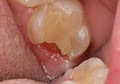 Dentist Emergency Australia image 6