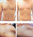 Evolution Laser Clinic Bondi Junction image 2