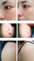 Evolution Laser Clinic Bondi Junction image 6