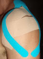 Kinesiology Tape Australia image 2