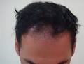 Australian Institute of Hair Restoration image 5