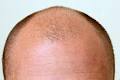 Hairline Solutions image 5