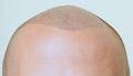 Hairline Solutions image 6