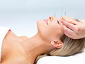 Cosmetic Acupuncture Perth logo