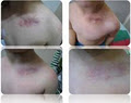 Evolution Laser Hair Removal Clinic image 1