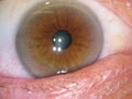 Brisbane Natural Therapies Mobile Iridology Clinic image 2