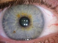 Brisbane Natural Therapies Mobile Iridology Clinic image 3