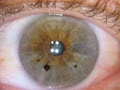 Brisbane Natural Therapies Mobile Iridology Clinic image 4