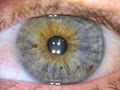 Brisbane Natural Therapies Mobile Iridology Clinic image 5