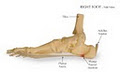 Heel Pain Centre image 2