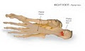 Heel Pain Centre image 3