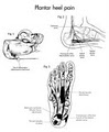 Heel Pain Centre image 4