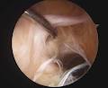 Shoulder and Knee Orthopaedics Perth image 2