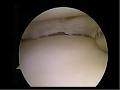 Shoulder and Knee Orthopaedics Perth image 5