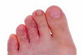 Podiatry Care Modbury image 3