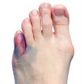 Podiatry Care Modbury image 5