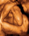 Precious Previews 3d/4d Ultrasound image 6